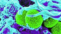 Las superbacterias ya matan más que el SIDA, la malaria y algunos cánceres