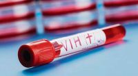 Descubrieron una nueva variante del VIH, más peligrosa y contagiosa