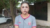 "La visera o la vida": Lo desfiguraron a la salida del boliche por una gorra